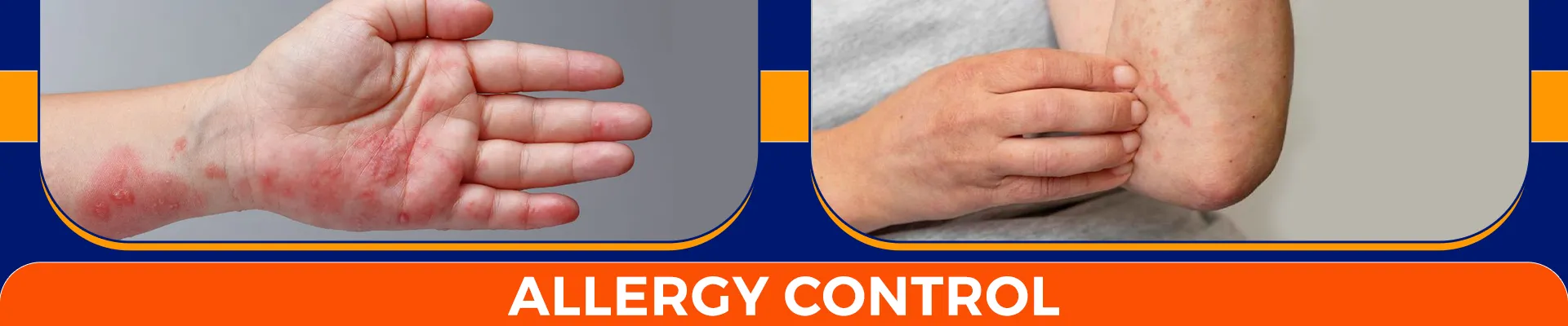 carpet cleaning in brooklyn, carpet cleaning in brooklyn, carpet cleaning brooklyn, carpet cleaners in brooklyn, carpet cleaners in brooklyn, commercial carpet cleaning, commercial carpet cleaning in brooklyn, brooklyn rug cleaners, rug cleaning services in brooklyn, same day carpet cleaning, same day rug cleaning